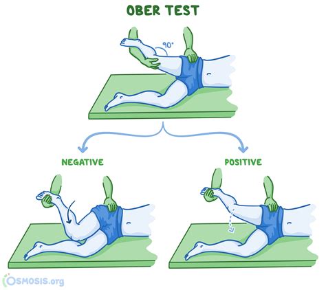 Special Tests: Test for distal ITB syndrome with the Noble compression test. 5. Test flexibility with the Ober test, Thomas test and 90/90 hamstring test. 5.